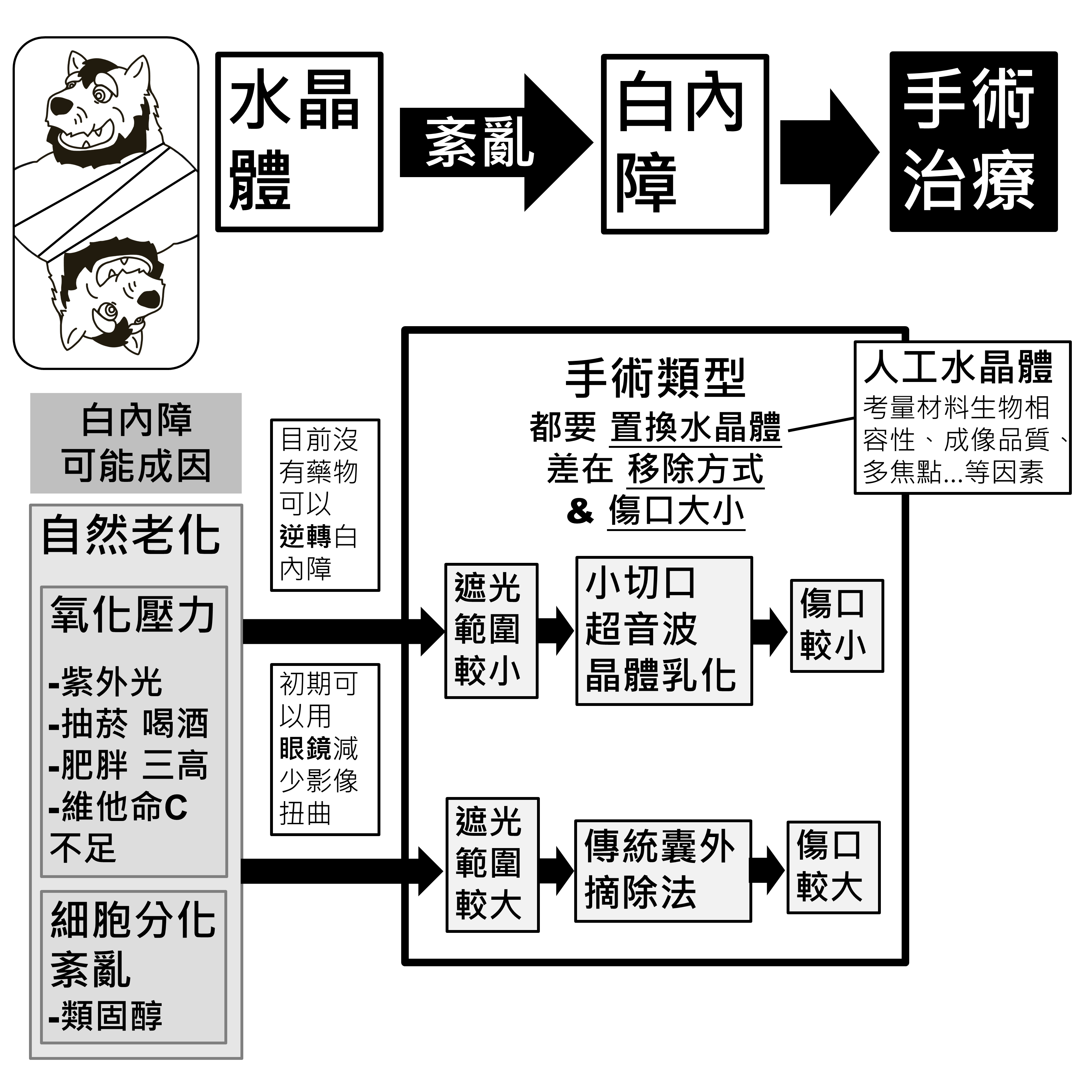 白內障治療：目前沒有藥物可以逆轉、初期可用眼鏡減少影像扭曲，以及遮光範圍大小對應的兩種手術方式與傷口大小